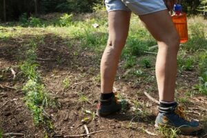 Woman with painful varicose veins on legs resting on a walk through nature. Varices, spider veins problems and active lifestyle prevention concept.
